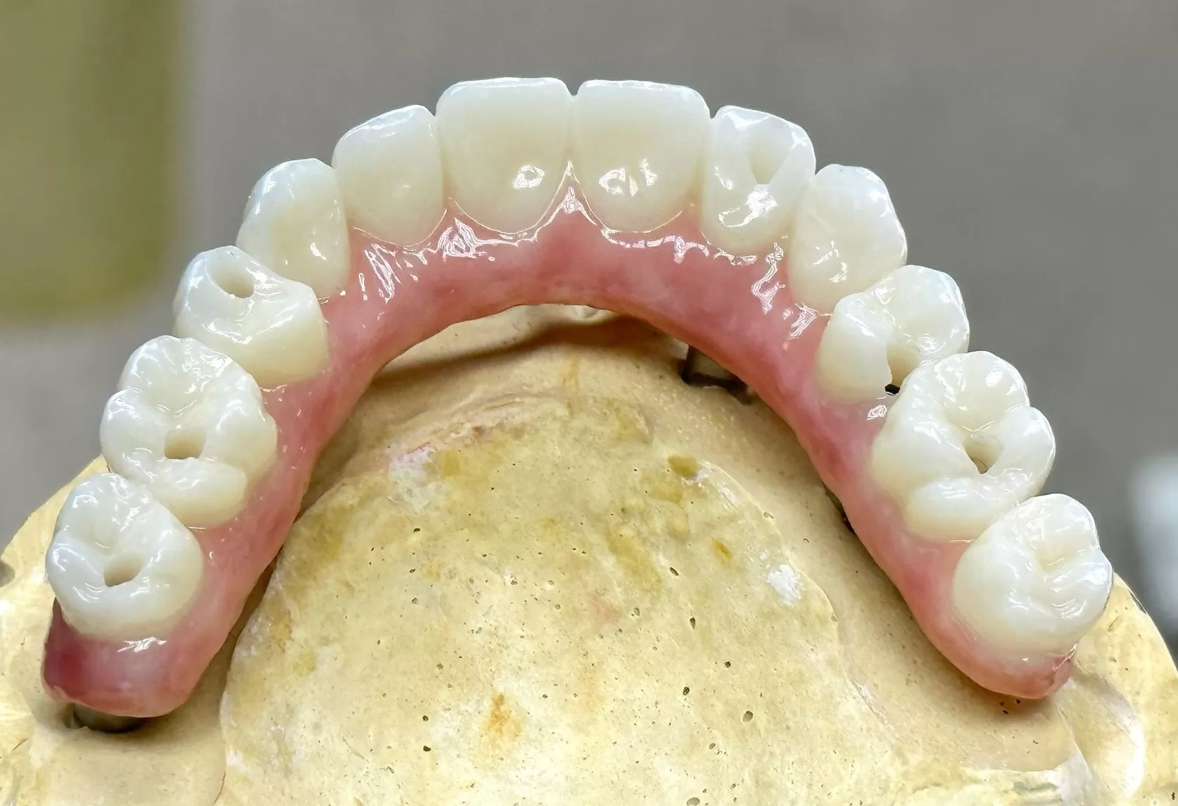 8 Steps to Achieve Perfect Dental Restorations with Zirconia Blocks