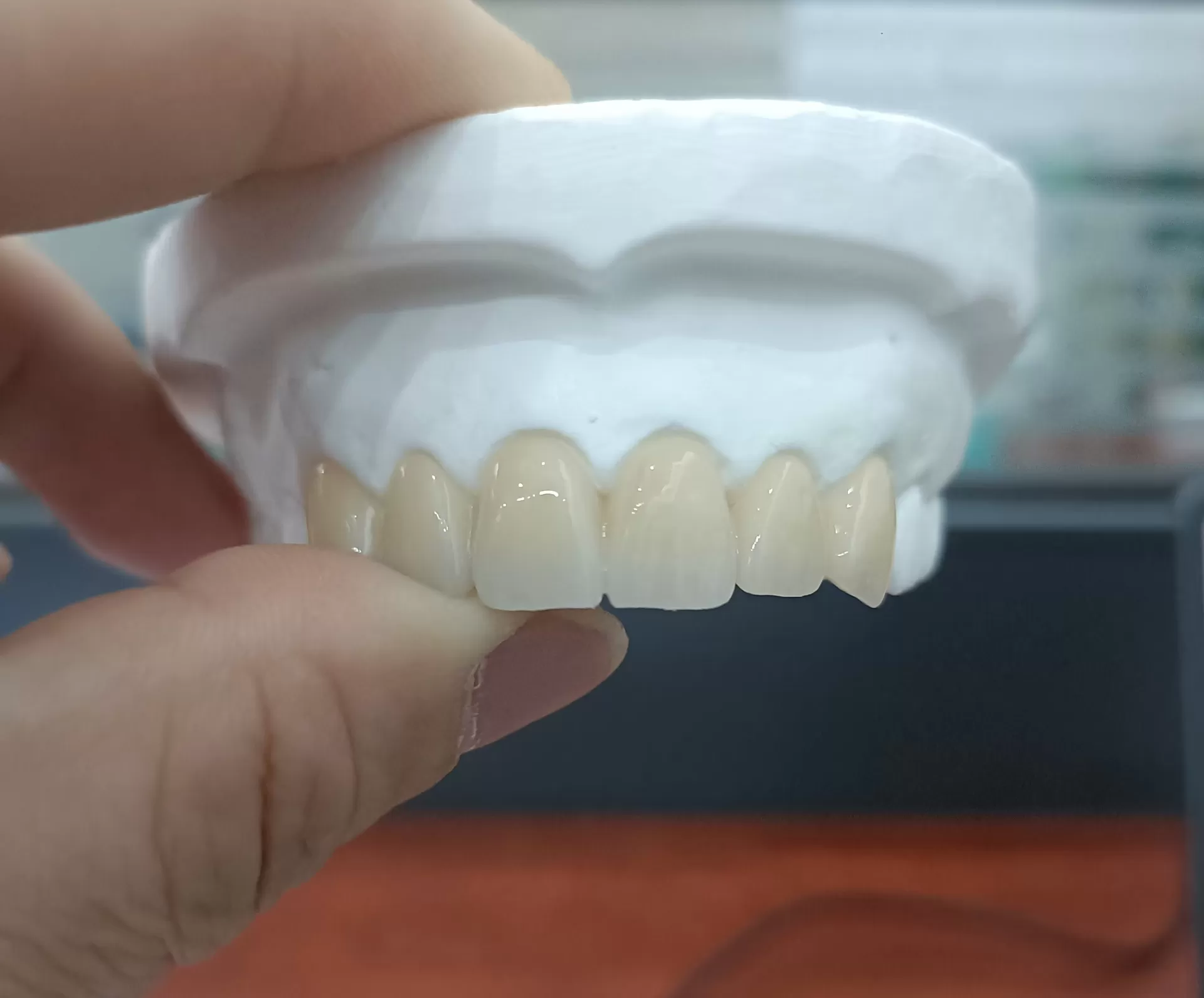 Top Benefits of Using Zirconia in Modern Dentistry