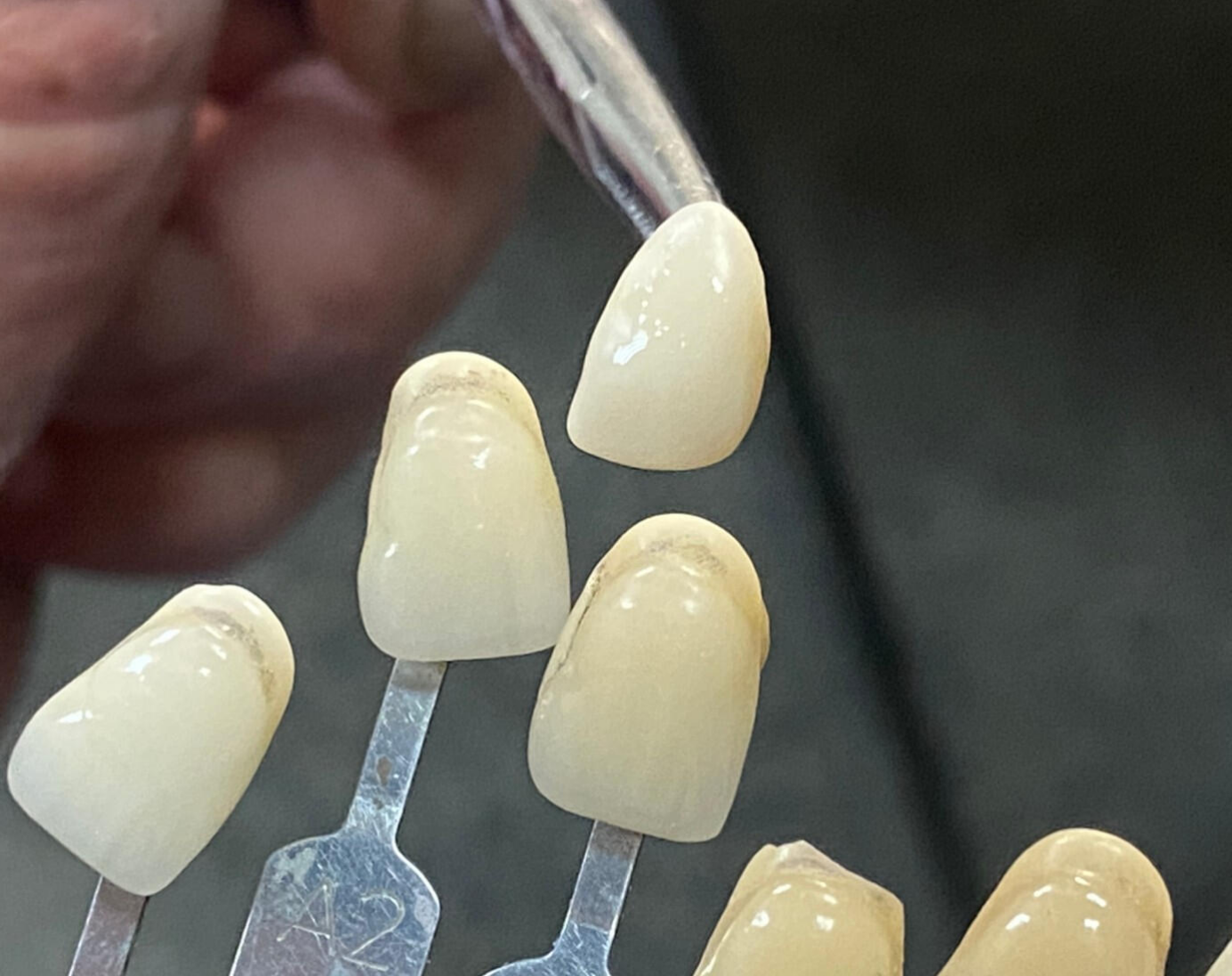 Zirconia Blocks in Modern Dentistry: Trends and Innovations